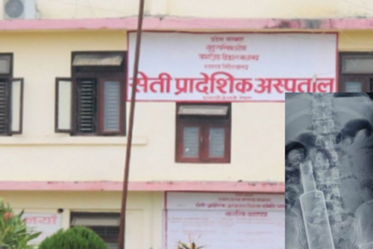 कैलालीमा एक व्यक्तिको पेटमा भेटियो रक्सीको बोटल