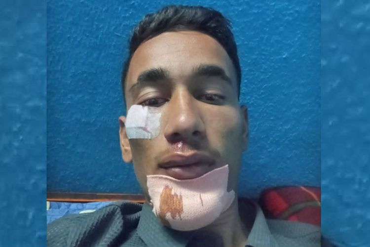 भक्तपुरको सानोठिमी क्याम्पसका स्ववियु अध्यक्षमाथि कुटपिट