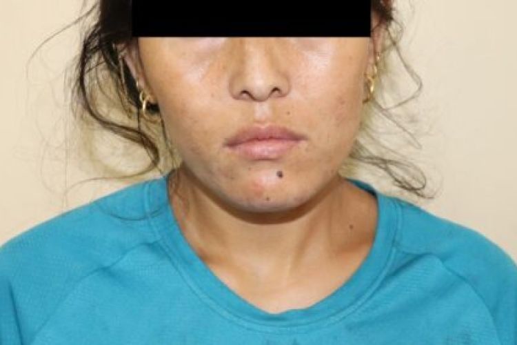 खाजा घरमा नाबालिकाहरुलाई वेश्यावृतीमा लगाउने इलामकी चिनीमायालाई १० बर्ष कैद