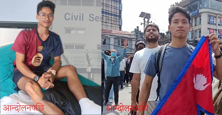 'गोली लागेर गाउँ फर्किँदा आमाले भावुक भएर भन्नुभयो– धन्न बाँचिस्! तँलाई देखेपछि सास आयो'